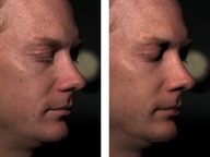 [Implementation Sketch: Processing and Editing of Faces using a Measurement-Based Skin Reflectance Model]