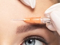 [Complications of Cosmetic Botulinum Toxin A Injections to the Upper Face: A Systematic Review and Meta-Analysis]