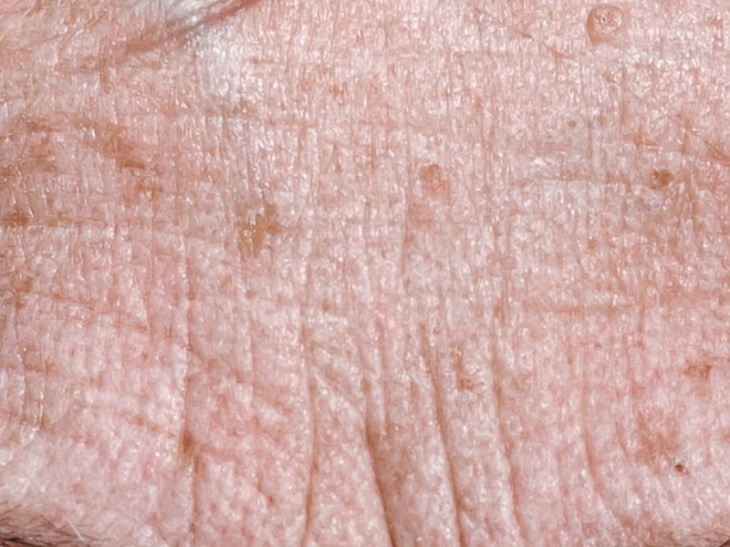 [Facial Skin Aging: an overview of biological aging processes]